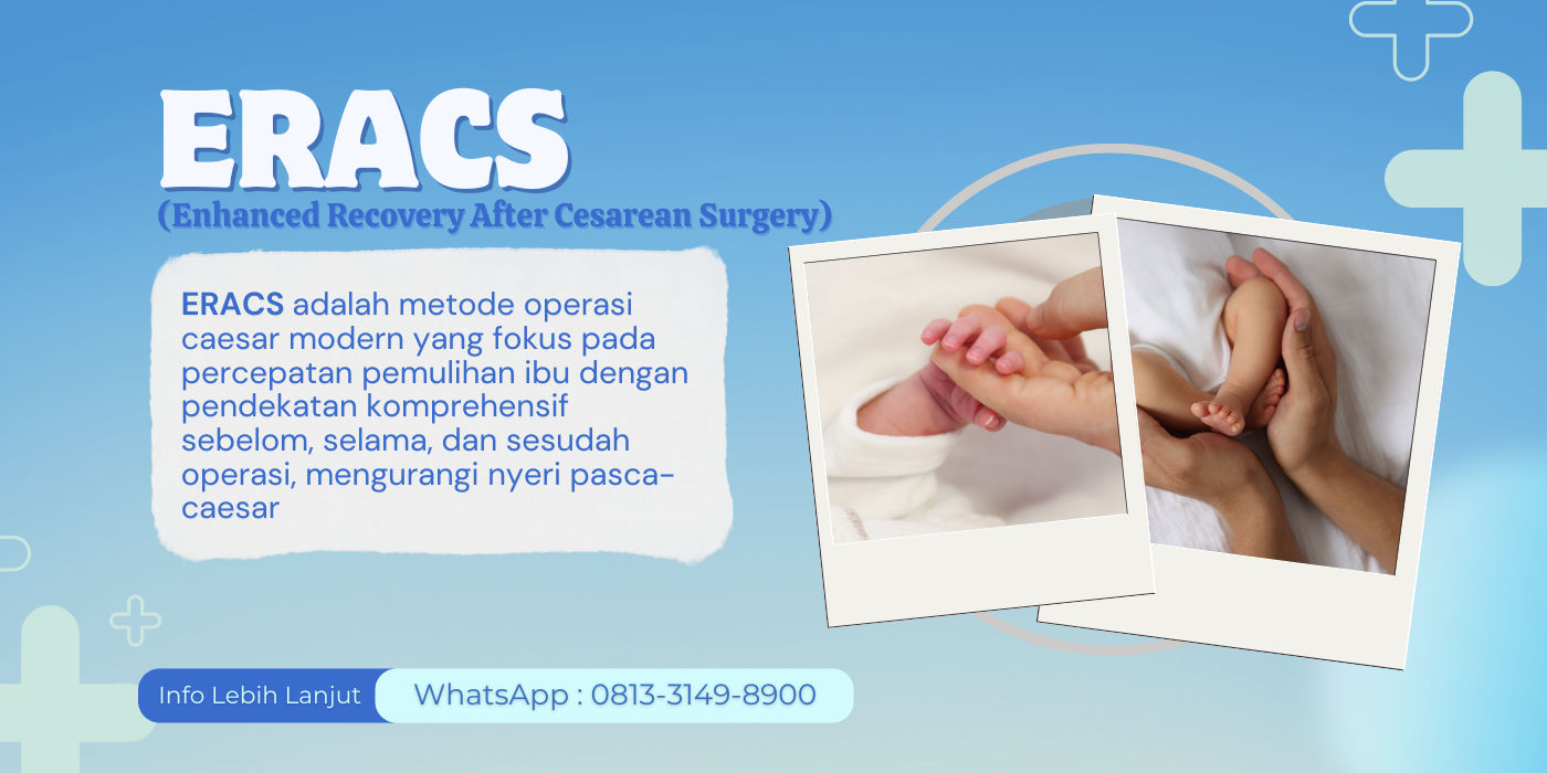 Persalinan ERACS